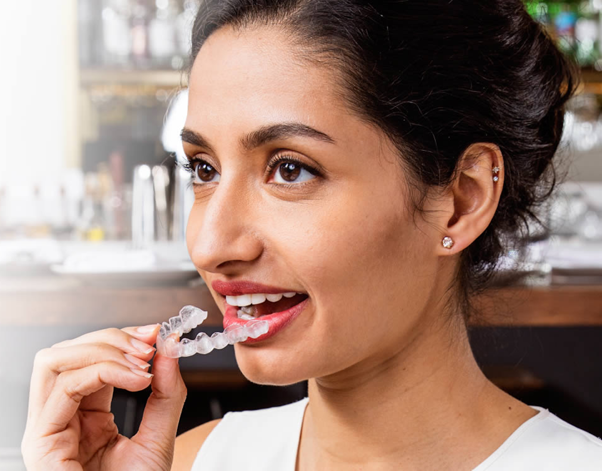 CrownWood Dental Google Ads case study